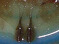 �J�u�g�G�r