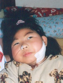 智ちゃん、ほっぺを切開